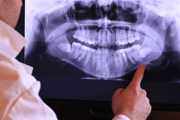 Best Emergency Dental Extractions in Rainbow Springs, FL