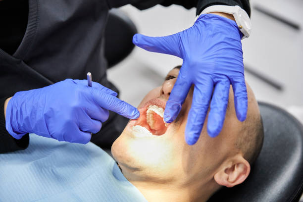 Best Broken or Cracked Tooth Emergency Dentist in Rainbow Springs, FL