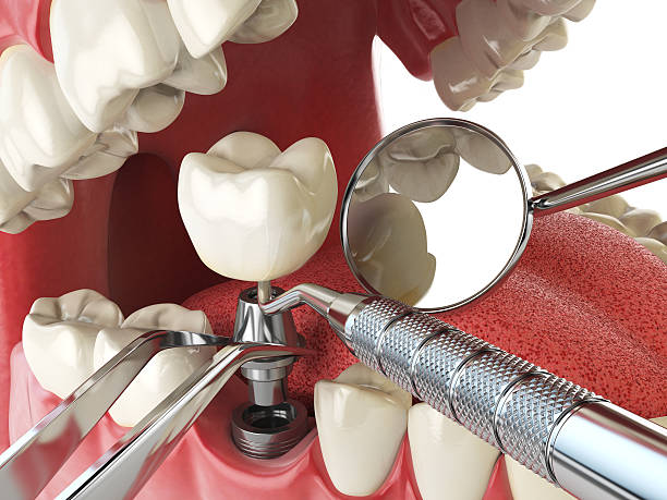Best Mobile Emergency Dentist in Rainbow Springs, FL